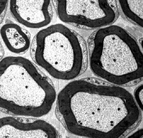 חתך רוחב בעצב היקפי המכיל כמה שלוחות תאי עצב, כפי שהוא נראה במיקרוסקופ אלקטרונים. מעטפות המיאלין נראות בשחור, ובמרכזן תאי העצב